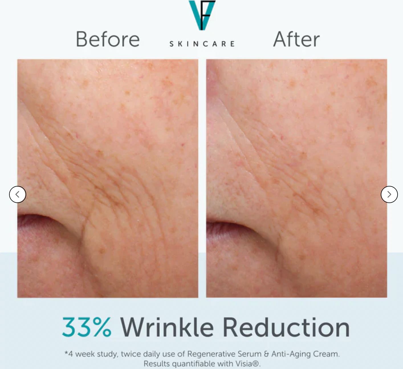 Factor Five Anti-Aging Cream