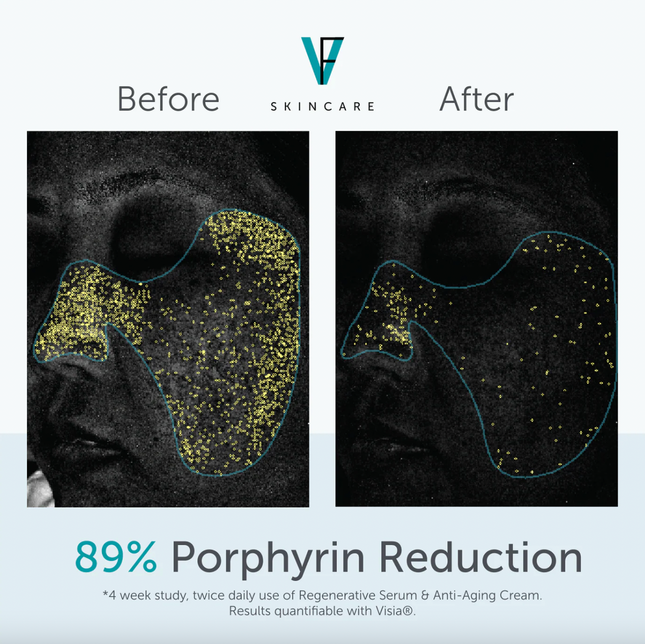 Factor Five Regenerative Serum