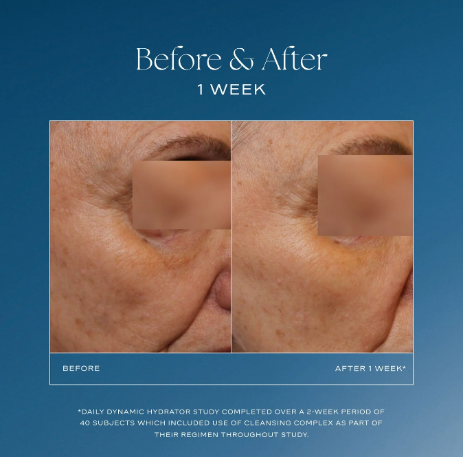 iS Clinical Daily Dynamic Hydrator, 1.7 fl oz