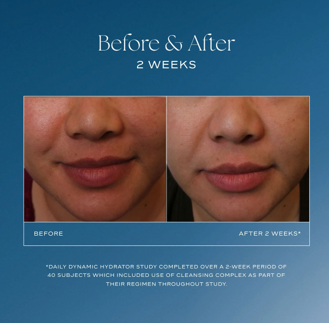 iS Clinical Daily Dynamic Hydrator, 1.7 fl oz